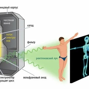 Как устроен рентген?