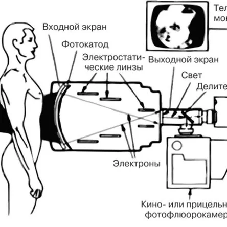 Область применения рентген-аппарата