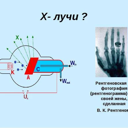Как генерируются рентгеновские лучи?