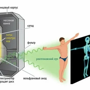 Как устроен рентген?