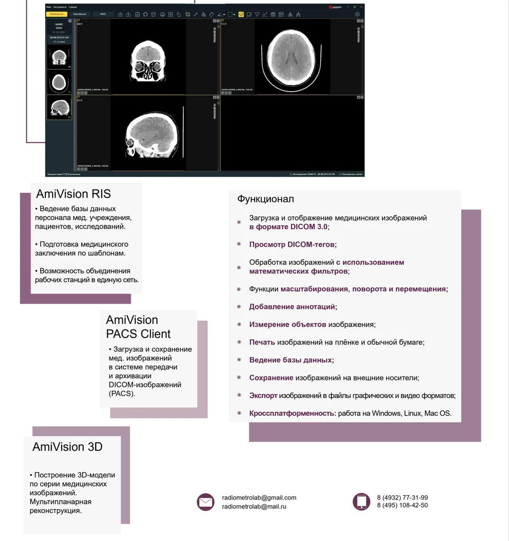 AmiVision - универсальный Dicom-просмотрщик