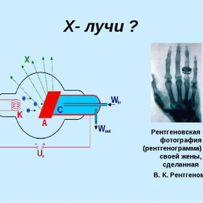 Как генерируются рентгеновские лучи?