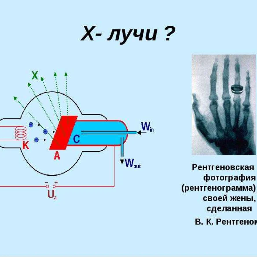 Как генерируются рентгеновские лучи?